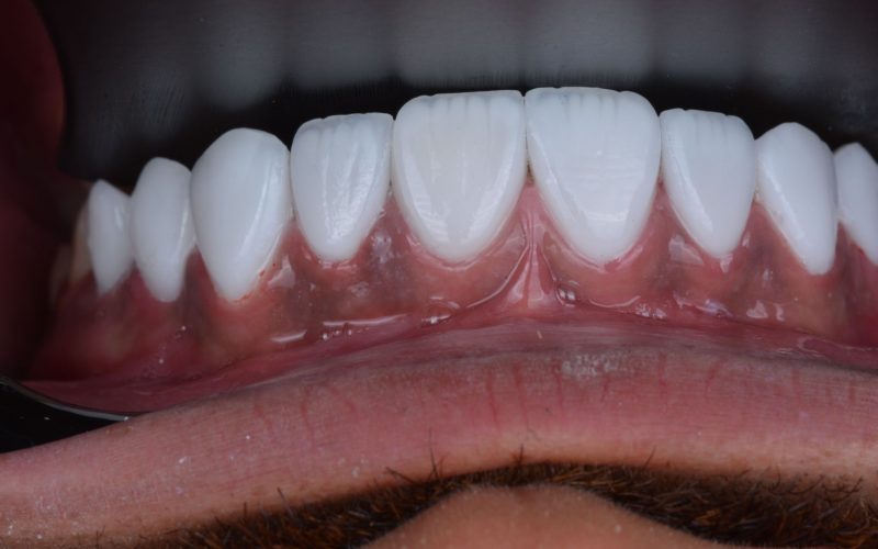 WhatsApp Image 2025-03-03 at 00.50.00_9831f17f